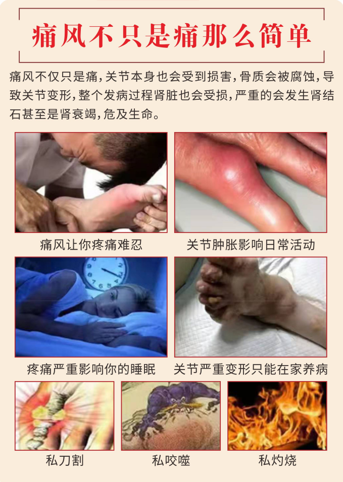 走進厚濟堂制藥有限公司痛風膏oem代加工全產(chǎn)業(yè)鏈一站式代工工廠