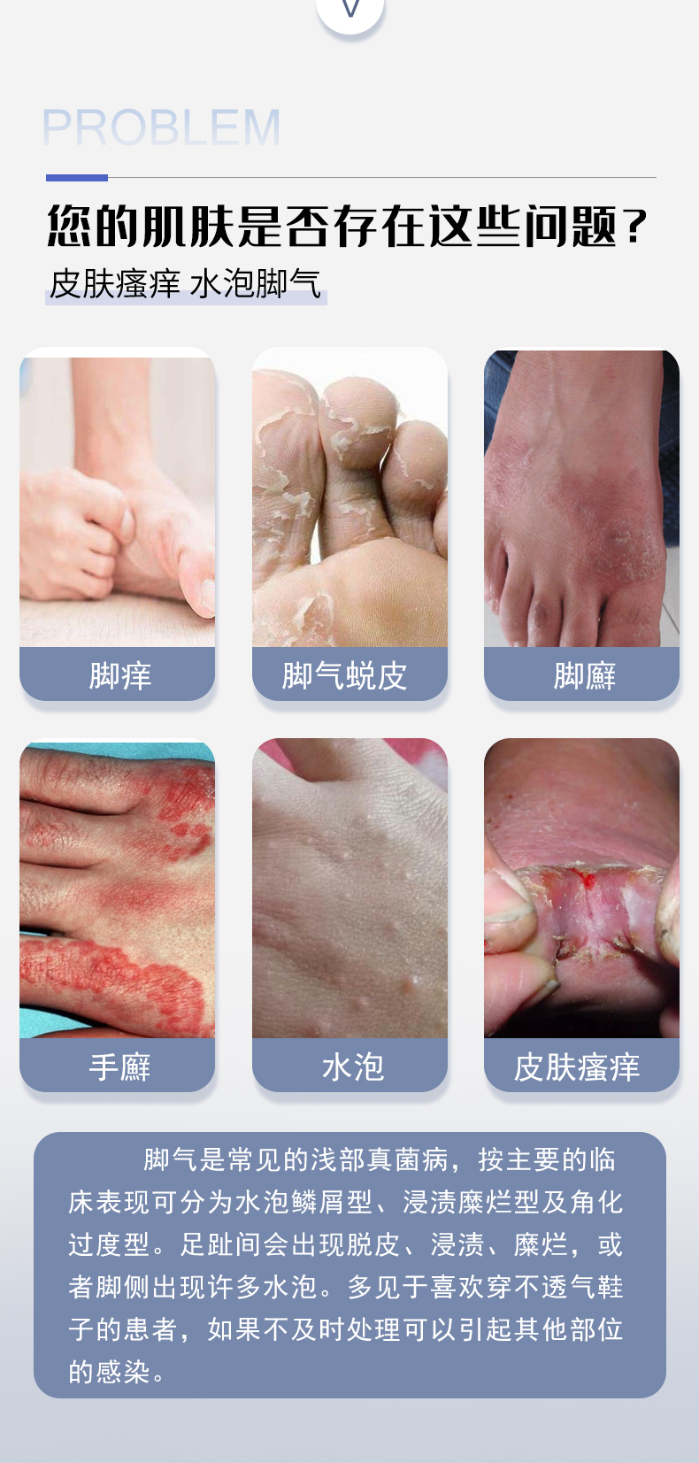 腳氣膏詳情_03.jpg